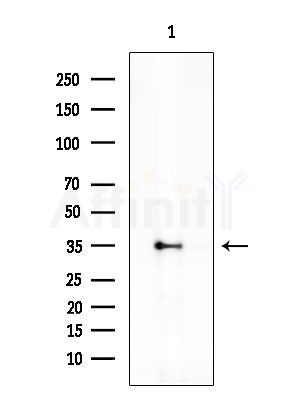 SIX6 Antibody - Western blot analysis of extracts from EC304 cells, using SIX6 Antibody at 1/1000 dilution.