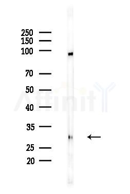 SIX6 Antibody - Western blot analysis of lysates from EC304 cells, using SIX6 Antibody at 1/1000 dilution.