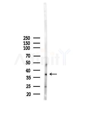 MAST4 Antibody - Western blot analysis of lysates from Mouse liver, using MAST4 Antibody at 1/1000 dilution.