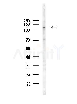 STA13 Antibody - Western blot analysis of lysates from LoVo cells(heat-shock,45min treatment), using STA13 Antibody at 1/1000 dilution.