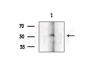Cytokeratin 14/16 Antibody - Western blot analysis of lysates from Mouse brain, using Cytokeratin 14/16 Antibody at 1/1000 dilution.