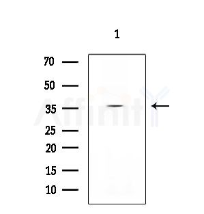 TTF2 Antibody - Western blot analysis of extracts from EC304 cells, using TTF2 Antibody at 1/1000 dilution.