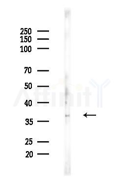 TTF2 Antibody - Western blot analysis of lysates from EC304 cells, using TTF2 Antibody at 1/1000 dilution.