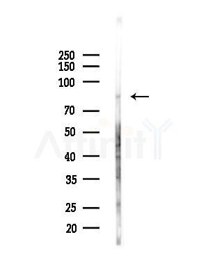FAP1 Antibody - Western blot analysis of lysates from HepG2 cells(LPS,4h treatment), using FAP1 Antibody at 1/1000 dilution.
