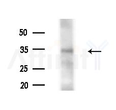 ZNF265 Antibody - Western blot analysis of extracts from HUVEC cells(starvation,24h treatment), using ZNF265 Antibody at 1/1000 dilution.