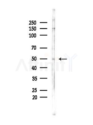 GABRG1 Antibody - Western blot analysis of lysates from B16F10-LUC cells(LPS,4h treatment), using GABRG1 Antibody at 1/1000 dilution.