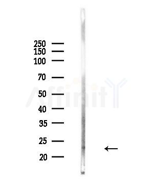 MRRF Antibody - Western blot analysis of lysates from Hela cells(UV,30min treatment), using MRRF Antibody at 1/1000 dilution.