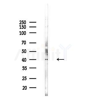 MOK Antibody - Western blot analysis of lysates from Hela cells(starvation,24h treatment), using MOK Antibody at 1/1000 dilution.