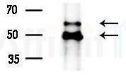 pan-AKT1/2/3 Antibody - Western blot analysis of lysates from A375 cells(heat-shock treatment), using pan-AKT1/2/3 Antibody at 1/1000 dilution.