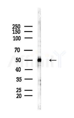 pan-AKT1/2/3 Antibody - Western blot analysis of lysates from COLO205 cells(heat-shock,45min treatment), using pan-AKT1/2/3 Antibody at 1/1000 dilution.