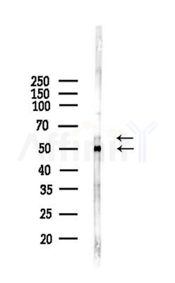 pan-AKT1/2/3 Antibody - Western blot analysis of lysates from Mouse liver, using pan-AKT1/2/3 Antibody at 1/1000 dilution.