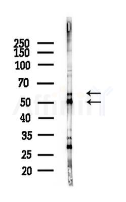 pan-AKT1/2/3 Antibody - Western blot analysis of lysates from A375 cells(heat-shock,45min treatment), using pan-AKT1/2/3 Antibody at 1/1000 dilution.