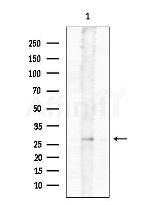 GFRA4 Antibody - Western blot analysis of extracts from EC304 cells, using GFRA4 Antibody at 1/1000 dilution.