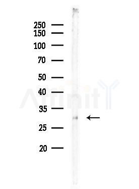 GFRA4 Antibody - Western blot analysis of lysates from EC304 cells, using GFRA4 Antibody at 1/1000 dilution.