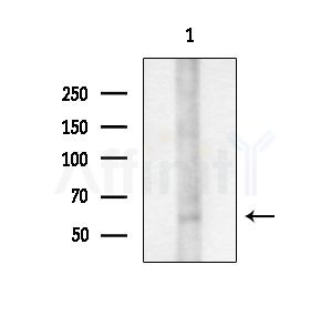 MAPKAPK5 Antibody - Western blot analysis of lysates from COLO205 cells, using MAPKAPK5 Antibody at 1/1000 dilution.