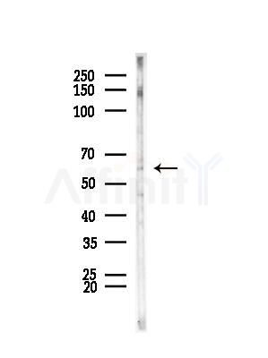 MAPKAPK5 Antibody - Western blot analysis of lysates from COLO205 cells, using MAPKAPK5 Antibody at 1/1000 dilution.