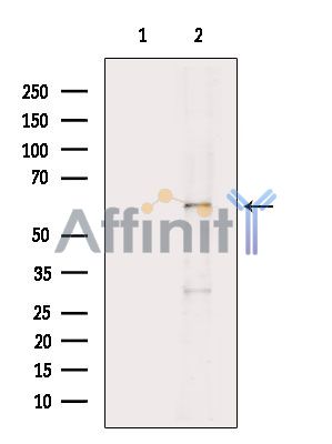 AKT1 Antibody - Western blot analysis of extracts from PC12(H2O2 treatment), using AKT1 Antibody.