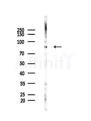 FER Antibody - Western blot analysis of lysates from Mouse liver, using FER Antibody at 1/1000 dilution.