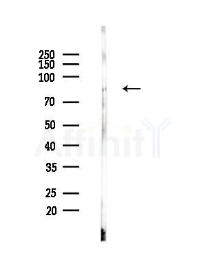 FER Antibody - Western blot analysis of lysates from Rat brain, using FER Antibody at 1/1000 dilution.