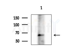Phospho-pan-AKT1/2/3 (Ser473) Antibody - Western blot analysis of lysates from 293 cells(LPS 4h treatment), using Phospho-pan-AKT1/2/3 (Ser473) Antibody at 1/1000 dilution.