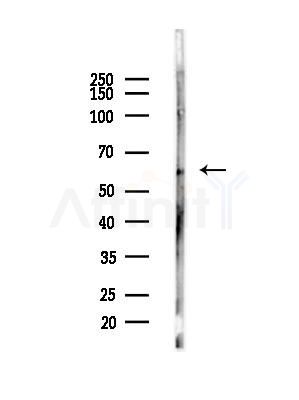 Phospho-pan-AKT1/2/3 (Ser473) Antibody - Western blot analysis of lysates from 293 cells(LPS,4h treatment), using Phospho-pan-AKT1/2/3 (Ser473) Antibody at 1/1000 dilution.