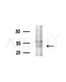 Phospho-Cyclin D1 (Thr286) Antibody - Western blot analysis of extracts from PC12 cells(starvation,24h treatment), using Phospho-Cyclin D1 (Thr286) Antibody at 1/1000 dilution.