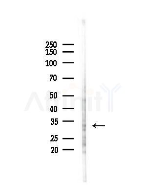 Phospho-Cyclin D1 (Thr286) Antibody - Western blot analysis of lysates from PC12 cells(starvation,24h treatment), using Phospho-Cyclin D1 (Thr286) Antibody at 1/1000 dilution.