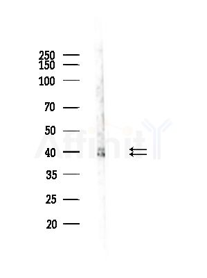 Phospho-ERK1/2 (Tyr204) Antibody - Western blot analysis of lysates from A375 cells(starvation,24h treatment), using Phospho-ERK1/2 (Tyr204) Antibody at 1/1000 dilution.