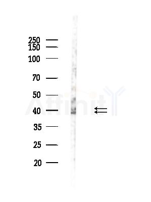 Phospho-ERK1/2 (Tyr204) Antibody - Western blot analysis of lysates from Hela cells(heat-shock,45min treatment), using Phospho-ERK1/2 (Tyr204) Antibody at 1/1000 dilution.