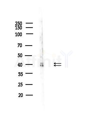 Phospho-ERK1/2 (Tyr204) Antibody - Western blot analysis of lysates from A375 cells(starvation,24h treatment), using Phospho-ERK1/2 (Tyr204) Antibody at 1/1000 dilution.