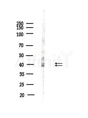 Phospho-ERK1/2 (Tyr204) Antibody - Western blot analysis of lysates from Hela cells(heat-shock,45min treatment), using Phospho-ERK1/2 (Tyr204) Antibody at 1/1000 dilution.