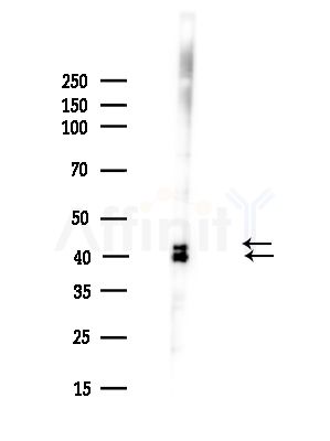 Phospho-ERK1/2 (Thr202/Tyr204) Antibody - Western blot analysis of lysates from A375 cells(heat-shock,45min treatment), using Phospho-ERK1/2 (Thr202/Tyr204) Antibody at 1/1000 dilution.