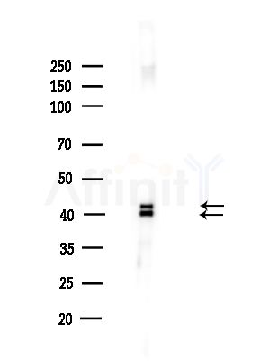 Phospho-ERK1/2 (Thr202/Tyr204) Antibody - Western blot analysis of lysates from HUVEC cells(UV,30min treatment), using Phospho-ERK1/2 (Thr202/Tyr204) Antibody at 1/1000 dilution.