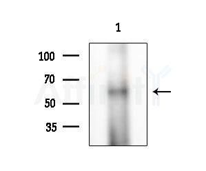 Phospho-pan-AKT1/2/3 (Tyr315/Tyr316/Tyr312) Antibody - Western blot analysis of extracts from A375 cells(heat-shock treatment), using Phospho-pan-AKT1/2/3 (Tyr315/Tyr316/Tyr312) Antibody at 1/1000 dilution.
