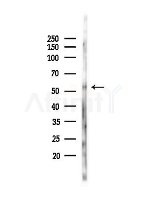 Phospho-pan-AKT1/2/3 (Tyr315/Tyr316/Tyr312) Antibody - Western blot analysis of lysates from A375 cells(heat-shock,45min treatment), using Phospho-pan-AKT1/2/3 (Tyr315/Tyr316/Tyr312) Antibody at 1/1000 dilution.