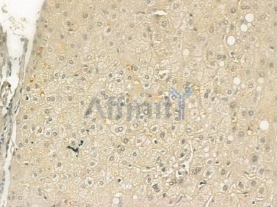 Phospho-Gab2 (Tyr643) Antibody - AF1417 at 1/100 staining human normal liver tissue by IHC-P.