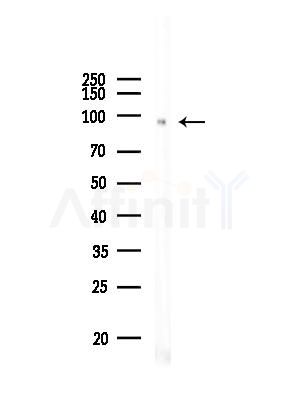 Phospho-NR3C1 (Ser211) Antibody - Western blot analysis of lysates from Mouse testis, using Phospho-NR3C1 (Ser211) Antibody at 1/1000 dilution.