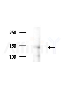 Phospho-JAK1 (Tyr1022)[Tyr1034] Antibody - Western blot analysis of lysates from B16F10-LUC cells(LPS,4h treatment), using Phospho-JAK1 (Tyr1022)[Tyr1034] Antibody at 1/1000 dilution.