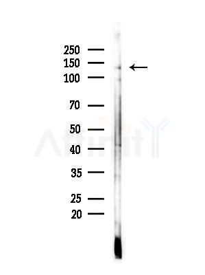 Phospho-JAK1 (Tyr1022)[Tyr1034] Antibody - Western blot analysis of lysates from B16F10-LUC cells(LPS,4h treatment), using Phospho-JAK1 (Tyr1022)[Tyr1034] Antibody at 1/1000 dilution.