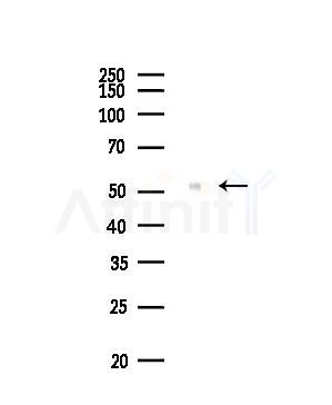 Phospho-Chk1 (Ser280) Antibody - Western blot analysis of lysates from PC12 cells(UV,30min treatment), using Phospho-Chk1 (Ser280) Antibody at 1/1000 dilution.