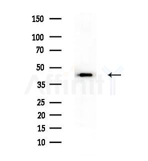 Phospho-GSK3 beta (Ser9) Antibody - Western blot analysis of extracts from B16F10-LUC cells(heat-shock treatment), using Phospho-GSK3 beta (Ser9) Antibody at 1/1000 dilution.