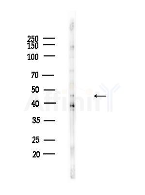 Phospho-GSK3 beta (Ser9) Antibody - Western blot analysis of lysates from B16F10-LUC cells(heat-shock,45min treatment), using Phospho-GSK3 beta (Ser9) Antibody at 1/1000 dilution.