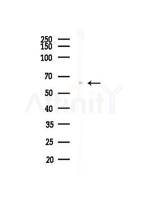 Phospho-c-Fos (Ser32) Antibody - Western blot analysis of lysates from COLO205 cells, using Phospho-c-Fos (Ser32) Antibody at 1/1000 dilution.