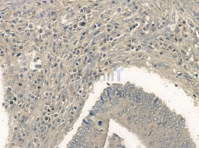 Phospho-RYR3 (Ser160) Antibody - AF2304 at 1/100 staining rat colorectal tissue by IHC-P.