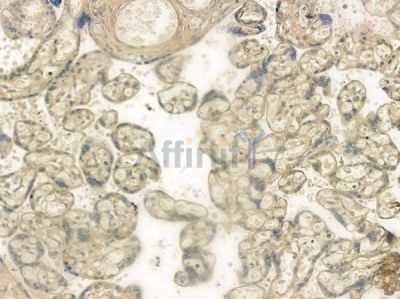 Phospho-GRK2 (Ser29) Antibody - AF2309 at 1/100 staining human normal placenta tissue by IHC-P.