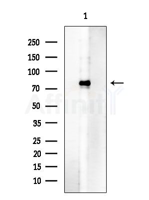 Phospho-ALK (Tyr1604) Antibody - Western blot analysis of lysates from COLO205 cells, using Phospho-ALK (Tyr1604) Antibody at 1/1000 dilution.