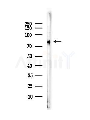 Phospho-ALK (Tyr1604) Antibody - Western blot analysis of lysates from COLO205 cells, using Phospho-ALK (Tyr1604) Antibody at 1/1000 dilution.