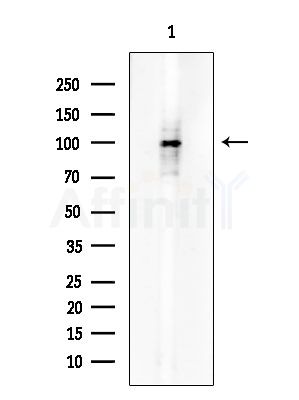 Phospho-DDR1 (Tyr513) Antibody - Western blot analysis of extracts from COLO205 cells, using Phospho-DDR1 (Tyr513) Antibody at 1/1000 dilution.