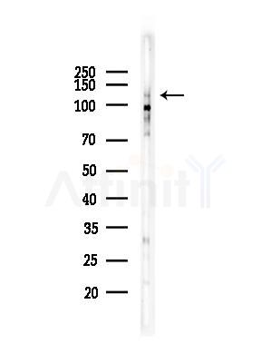 Phospho-DDR1 (Tyr513) Antibody - Western blot analysis of lysates from COLO205 cells, using Phospho-DDR1 (Tyr513) Antibody at 1/1000 dilution.