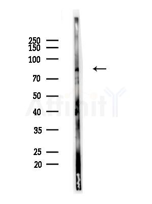 Phospho-Atg13 (Ser355) Antibody - Western blot analysis of lysates from COLO205 cells(heat-shock,45min treatment), using Phospho-Atg13 (Ser355) Antibody at 1/1000 dilution.